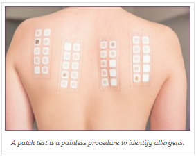 Test patch Allergy Patch